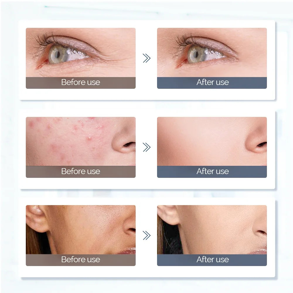 Foreverlily visage cou Silicone masque LED 7 couleurs lumière LED photonique thérapie 3D Flexible masque de beauté du visage peau éclaircir soins de la peau by Sirius Flow