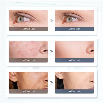 Foreverlily visage cou Silicone masque LED 7 couleurs lumière LED photonique thérapie 3D Flexible masque de beauté du visage peau éclaircir soins de la peau by Sirius Flow