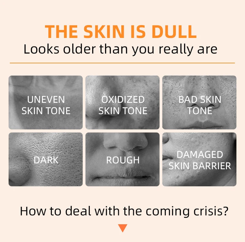 Gel exfoliant Orange dissolvant de taches morts éclaircir Peeling 50g réparation douce gommage blanchir hydratant soin de la peau coréen by Sirius Flow